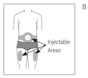 Treatment Of Rheumatoid Arthritis