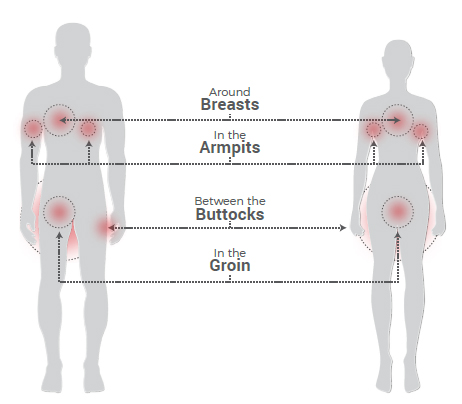 Swollen Joint Count